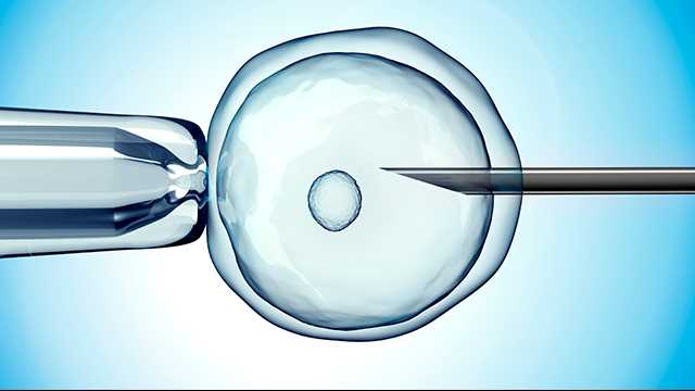 Cost of IVF with ICSI in Georgia