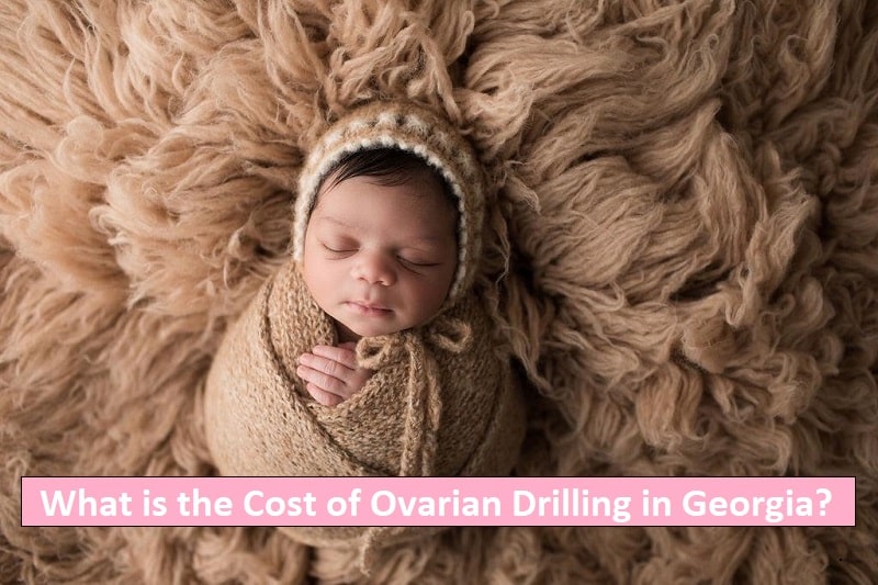 Cost of Ovarian Drilling in Georgia