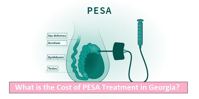 Cost of PESA Treatment in Georgia