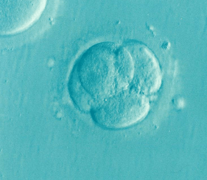 Best IVF Centre in Georgia 2020